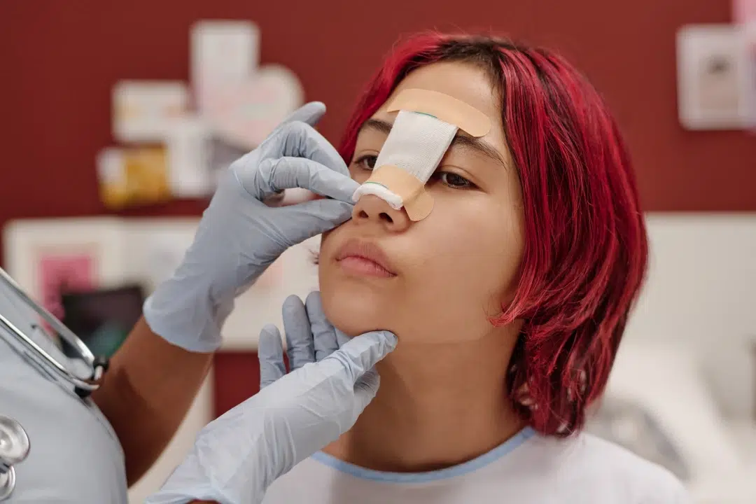 Rhinoplastie ultrasonique : la révolution douce pour un nez harmonieux et une récupération plus rapide